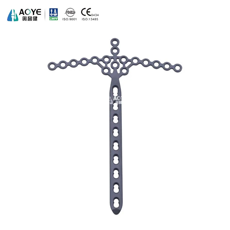 Placa de bloqueo en forma de ala para tibia distal