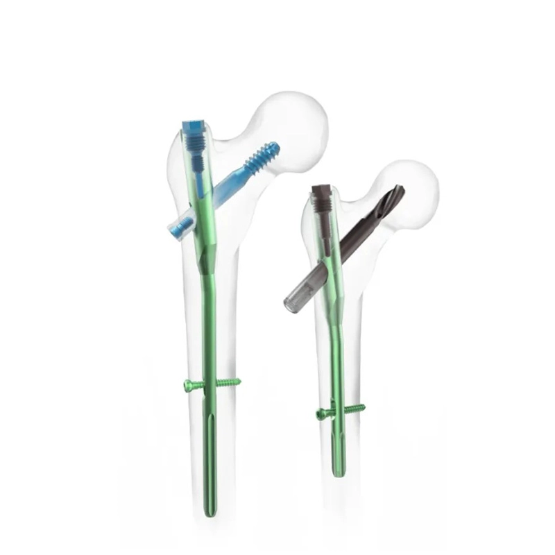 Clavo intramedular PFNA | Implante femoral proximal de titanio